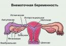 Symptome einer Eileiterschwangerschaft im Frühstadium und Behandlung Welche Pillen unterbrechen eine Eileiterschwangerschaft