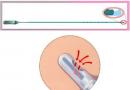 Pipelová biopsie endometria